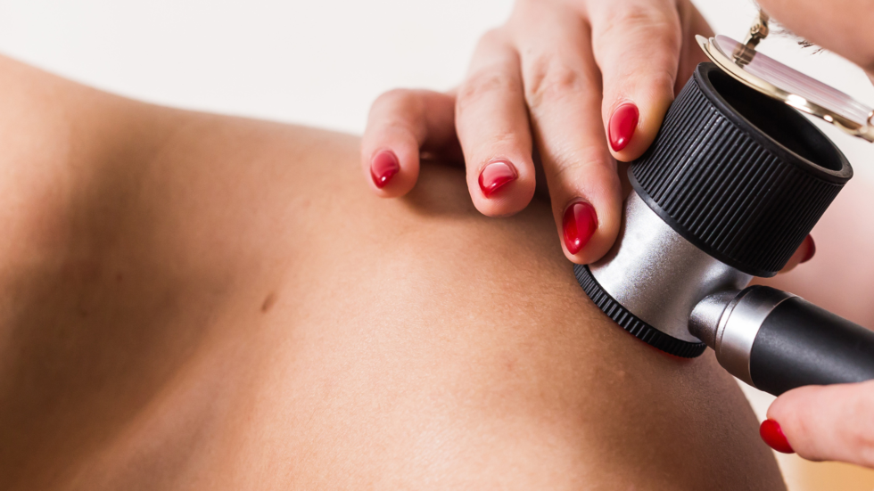 Czym jest wideodermatoskopia?